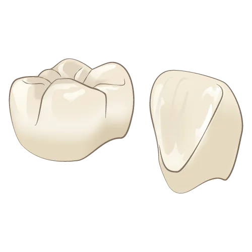 オールセラミック