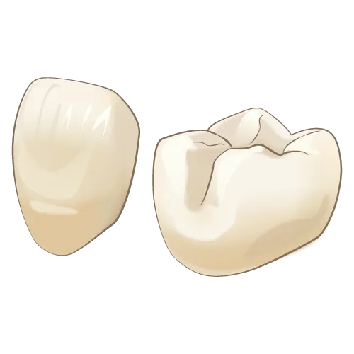 ハイブリットセラミック